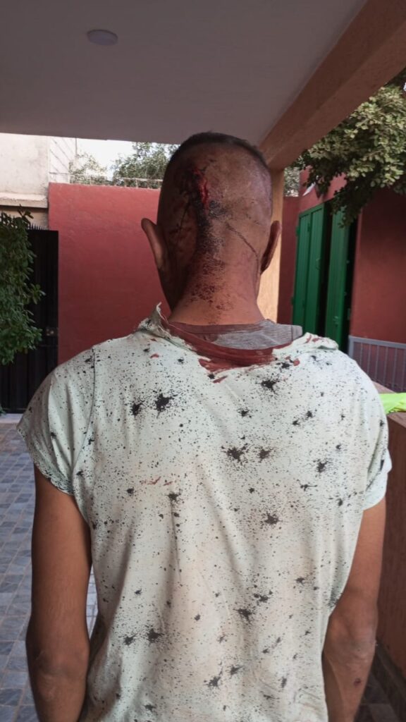 قصبة تادلة: اعتداء خطير على شاب بأولاد سعيد الواد والجناة مازالوا أحراراً