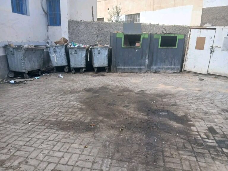 مطالب بنقل حاويات النفايات من محيط مركز تشخيص داء السل بالناظور
